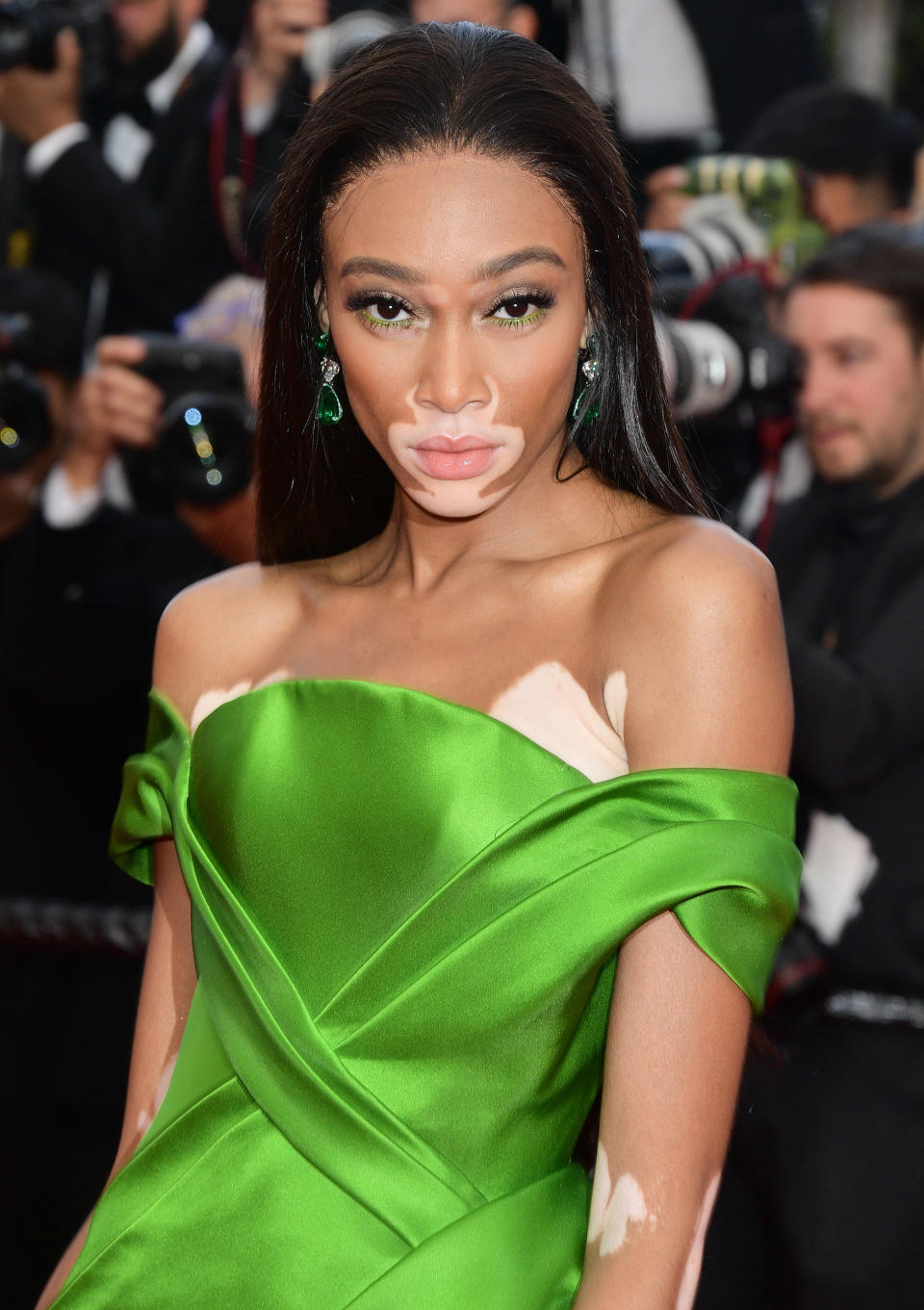 America's Next Top Model's Winnie Harlow Defends Comments on Show