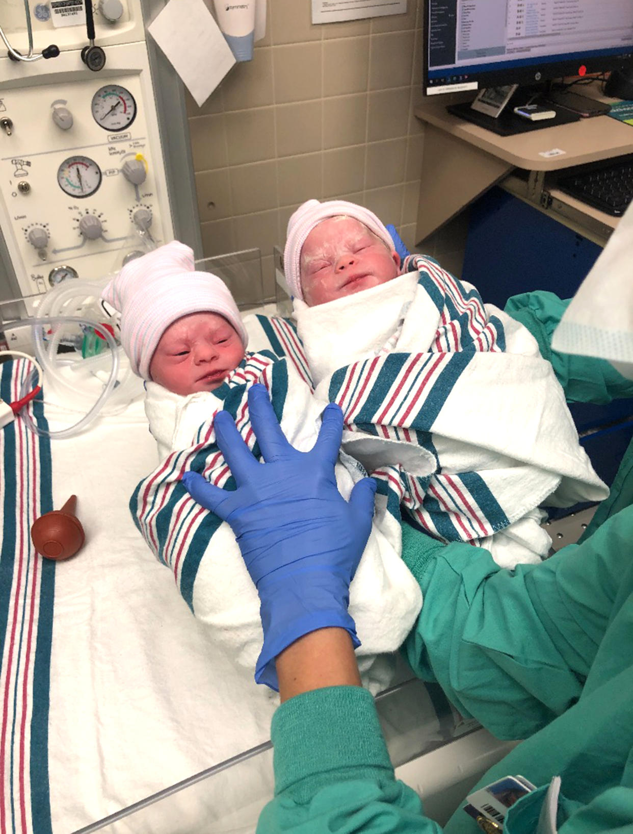 Medical experts say the chances of both twins being born with Down syndrome are exceedingly rare. (Courtesy Savannah Combs)