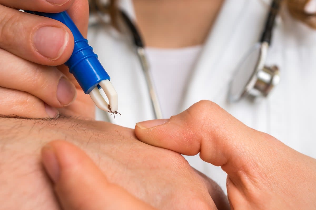 Tick bites are the most common method of infection (Getty Images/iStockphoto)