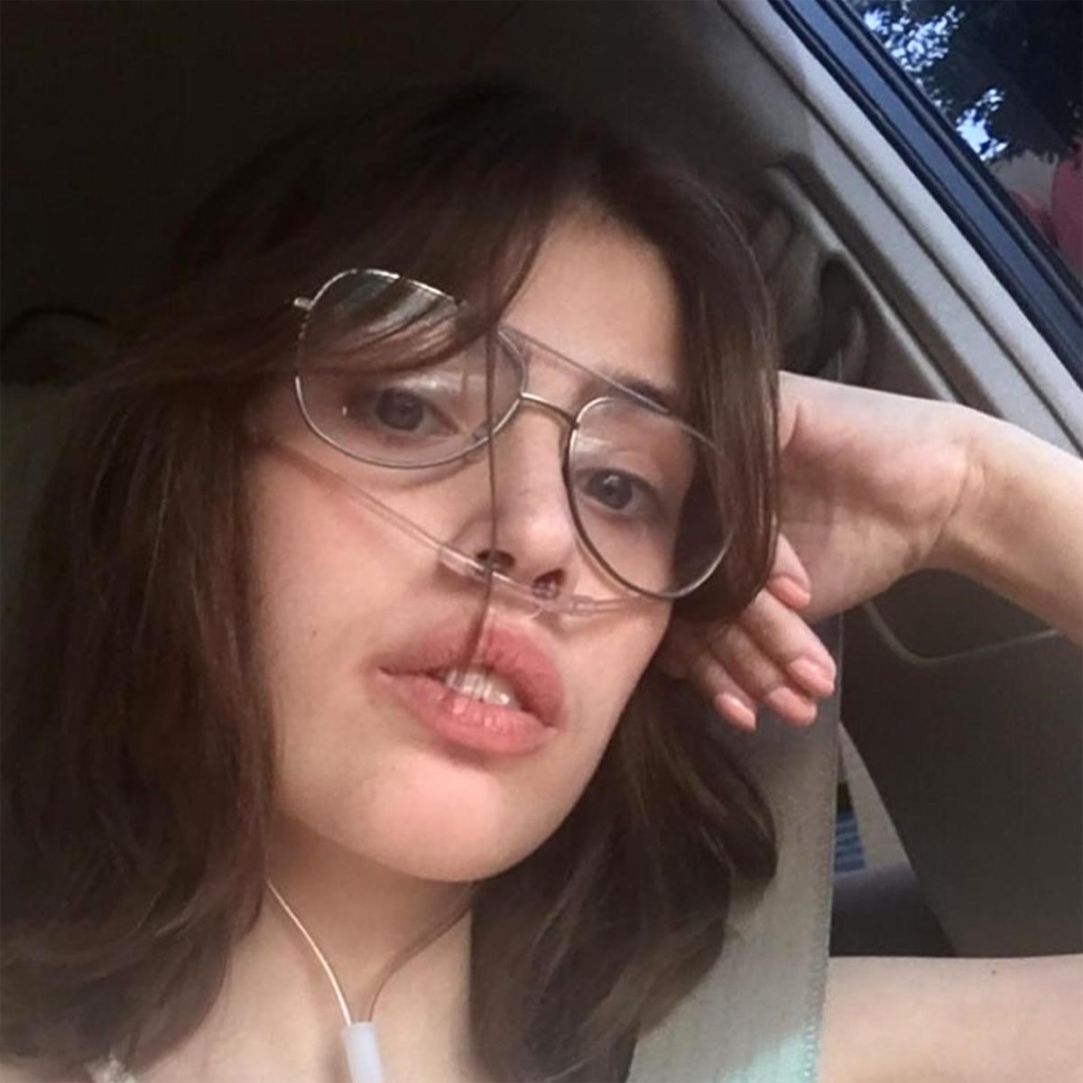 Claire Wineland, inspirational speaker and social media star, dies one week  after lung transplant