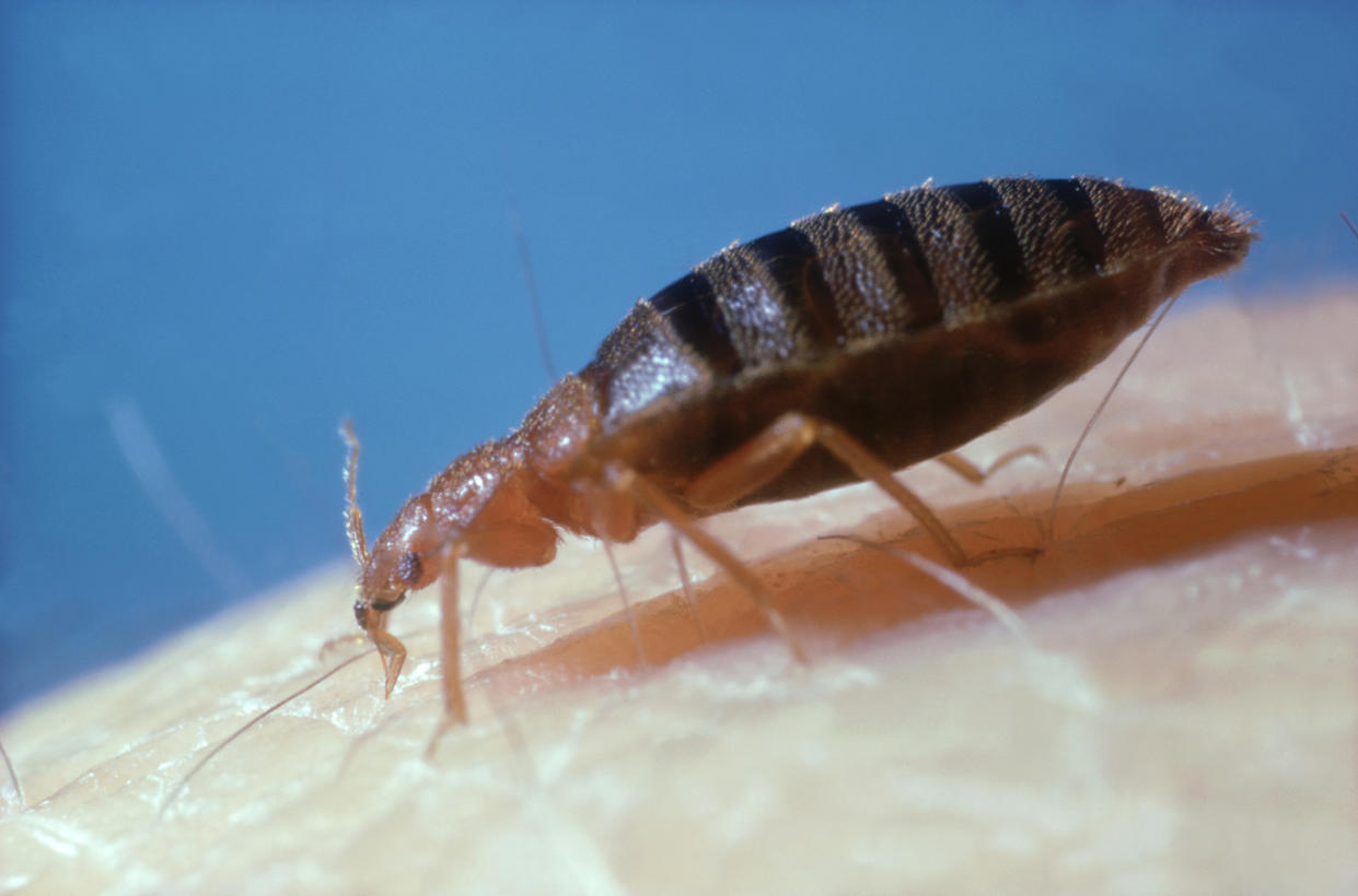 Officials say there are no public health concerns if the UK experiences a bedbug infestation. (Getty)