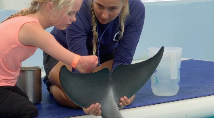 Ellie Challis, who lost her arms and legs to a severe case of meningitis, has a special bond with a dolphin named Winter. (Photo: Clearwater Marine Aquarium)