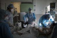 FILE - In this Tuesday, Feb. 2, 2021 file photo, nurses transfer a sixteen-year-old patient suffering from COVID-19 into the ICU at the La Timone hospital in Marseille, southern France. COVID-19 patients occupy 88% of the Marseille region's intensive care beds, and virus pressure on French hospitals is steadily rising in recent weeks despite curfews and other restrictions. (AP Photo/Daniel Cole, File)