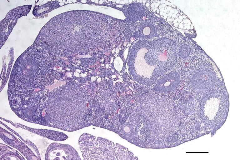Ovario de uno de los ratones modificados para producir más óvulos