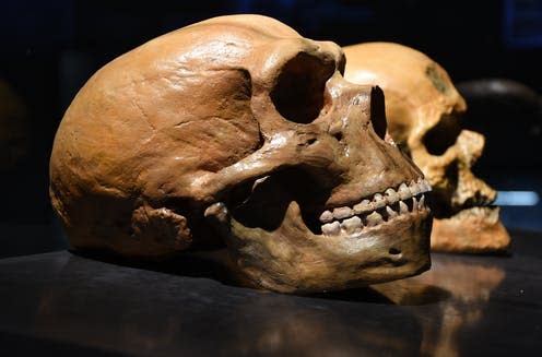 <span class="caption">The brains of humans are subtly different from those of Neanderthals.</span> <span class="attribution"><a class="link " href="https://www.shutterstock.com/image-photo/neanderthal-vs-human-skull-470033498" rel="nofollow noopener" target="_blank" data-ylk="slk:Petr Student/Shutterstock;elm:context_link;itc:0;sec:content-canvas">Petr Student/Shutterstock</a></span>
