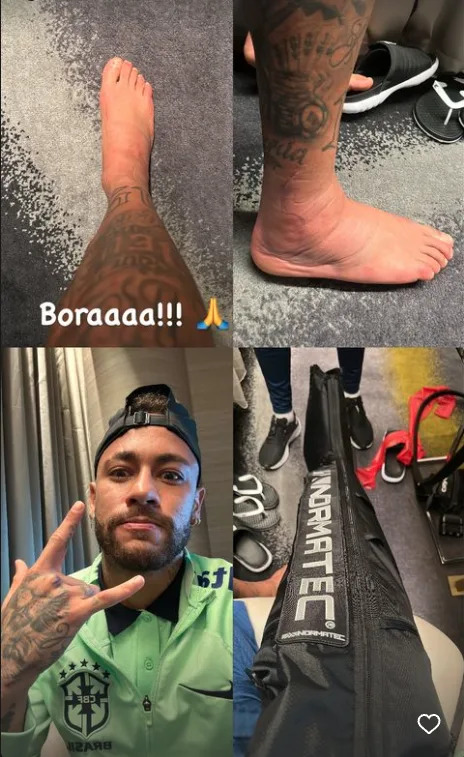Neymar publica imagens do tornozelo durante tratamento para retornar &#xe0; equipe ainda na Copa do Mundo (Foto: Reprodu&#xe7;&#xe3;o/Instagram)