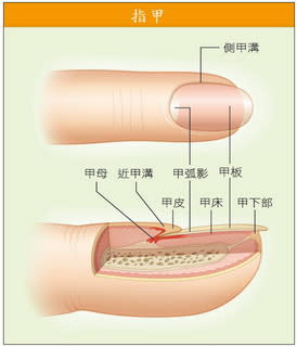 Onychomycosis