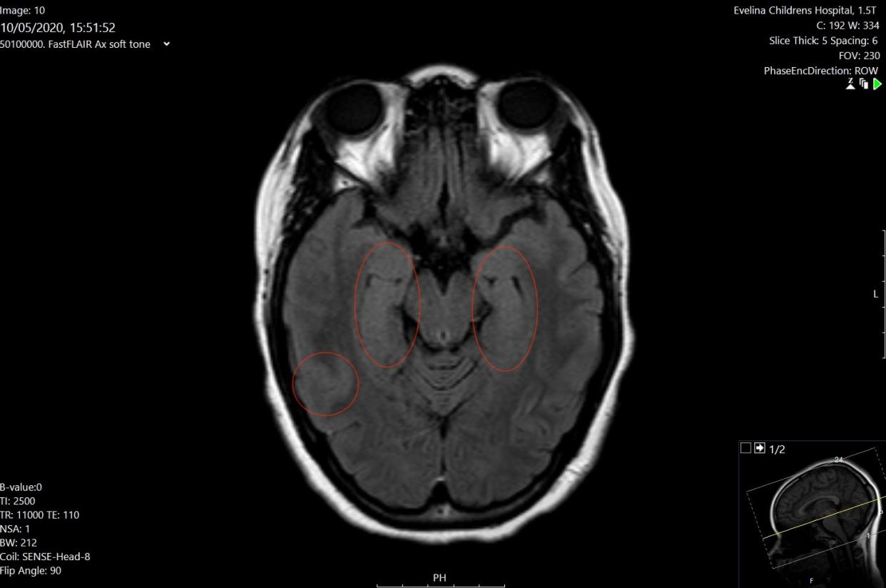 MRI scan (Evelina Children's Hospital, London)