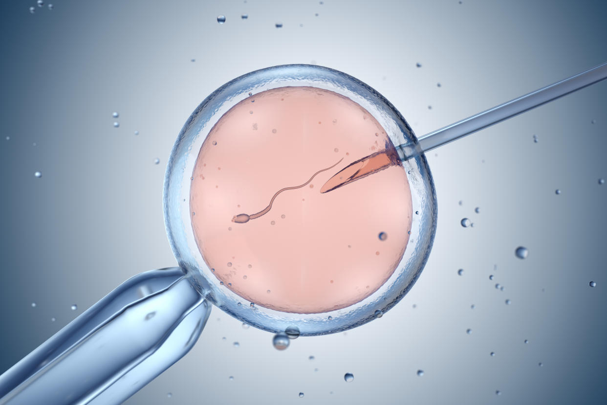 An illustration of in vitro fertilization.