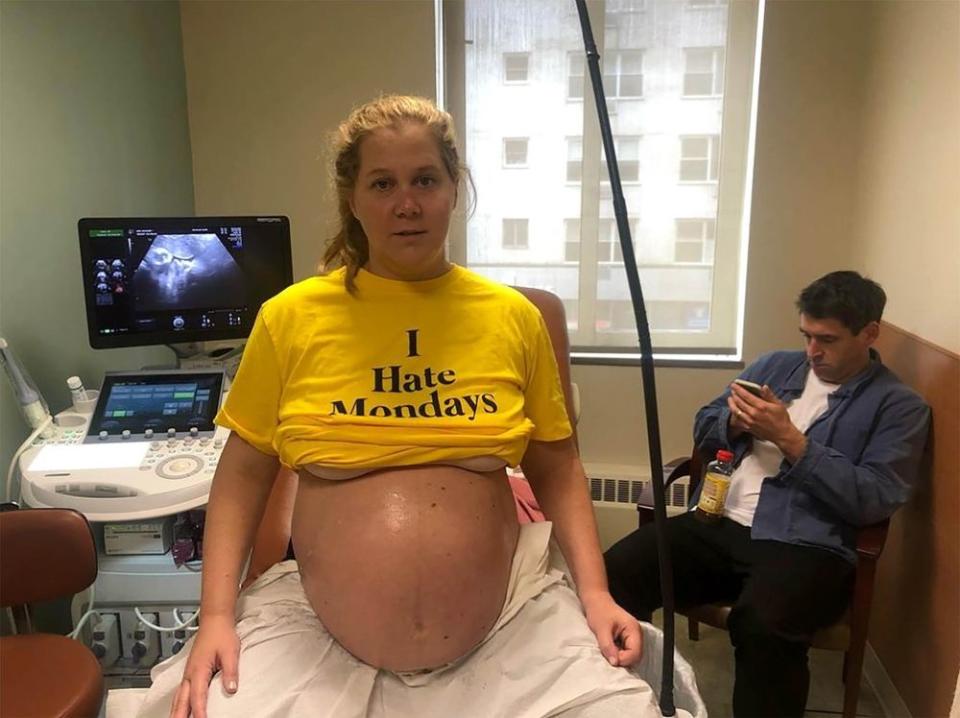 Amy Schumer | Amy Schumer/Instagram