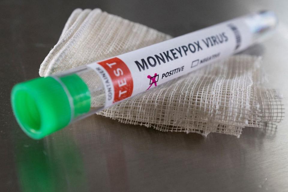 全球非猴痘疫區國家累計約1300起病例。圖為標有「猴痘病毒陽性」的試管。（路透）