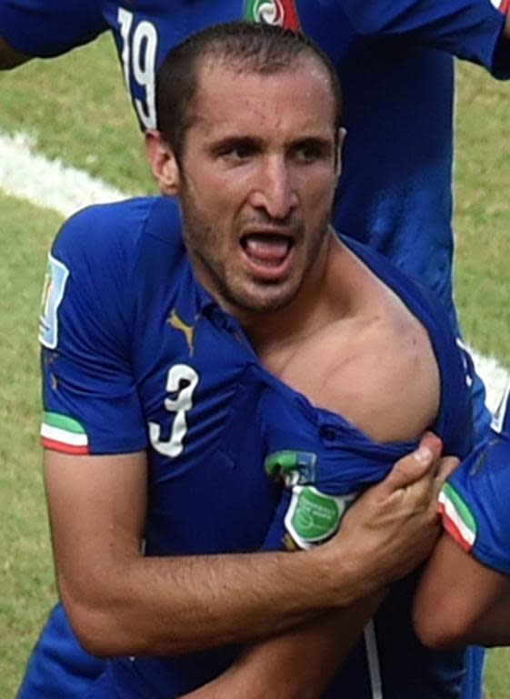 Italy's defender Giorgio Chiellini shows an apparent bitemark by Uruguay forward Luis Suarez during a Group D football match between Italy and Uruguay at the Dunas Arena in Natal during the 2014 FIFA World Cup on June 24, 2014