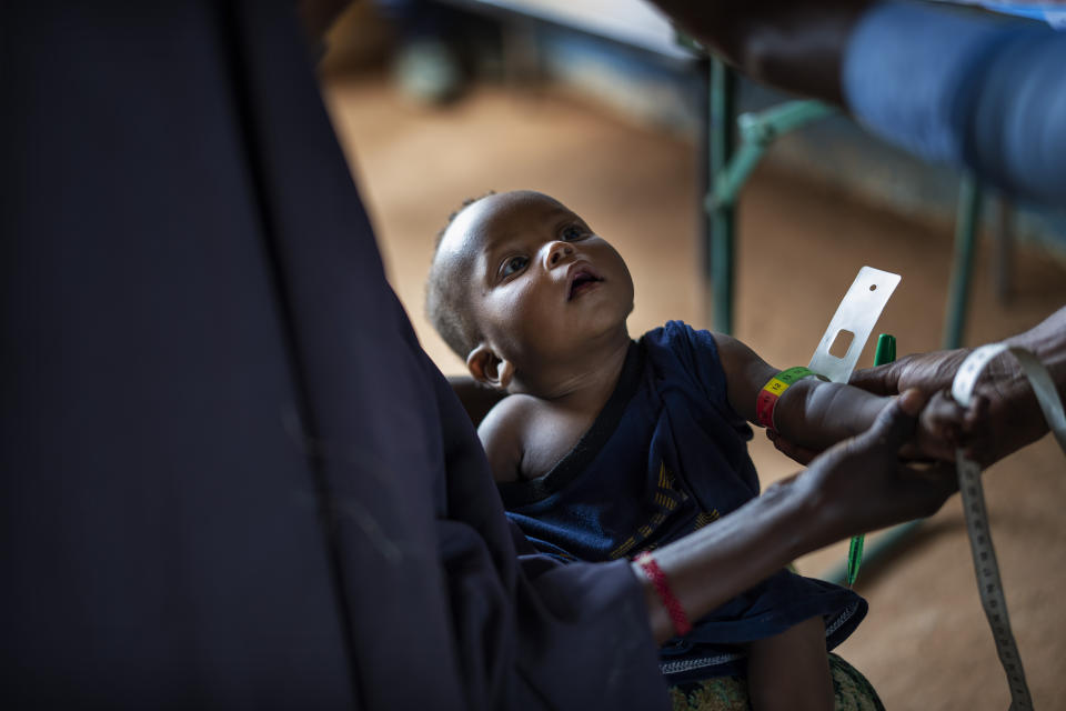 A child is measured at a camp for displaced people on the outskirts of Dollow, Somalia, on Monday, Sept. 19, 2022. Somalia is in the midst of the worst drought anyone there can remember. A rare famine declaration could be made within weeks. Climate change and fallout from the war in Ukraine are in part to blame. (AP Photo/Jerome Delay)