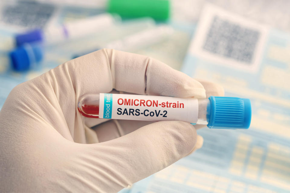 Doctor with a positive blood sample for new variant detected of the coronavirus strain called covid Omicron. Research of new african strains and mutations of the Covid 19 coronavirus in the laboratory