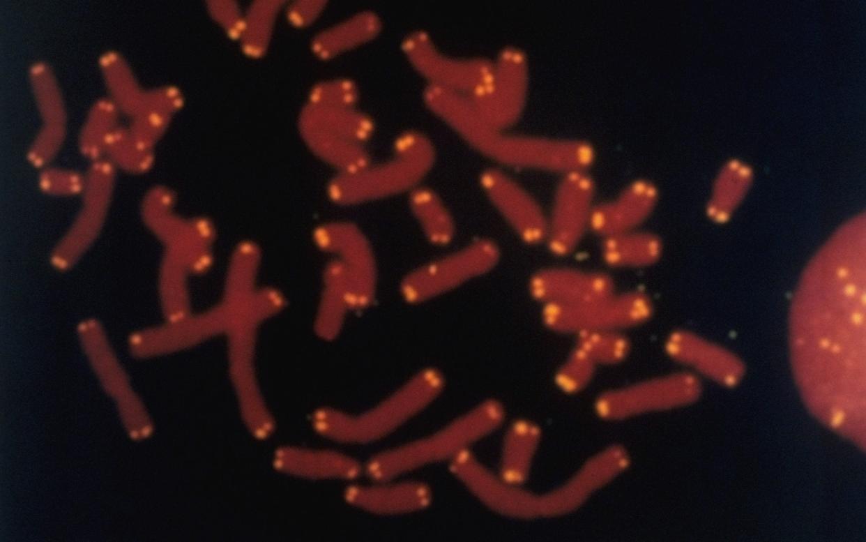 Human chromosomes - The LIFE Images Collection /Los Alamos National Laboratory 