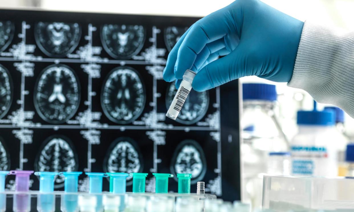 <span>The Food and Drug Administration has delayed approval of Alzheimer’s drug donanemab and wants a panel to scrutinise safety and efficacy data.</span><span>Photograph: Tek Image/Science Photo Library/Getty Images</span>