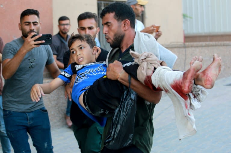 Un niño palestino herido ingresa en el hospital Nasser de Jan Yunis, en el sur de la Franja de Gaza, el 24 de julio de 2024 (Bashar Taleb)