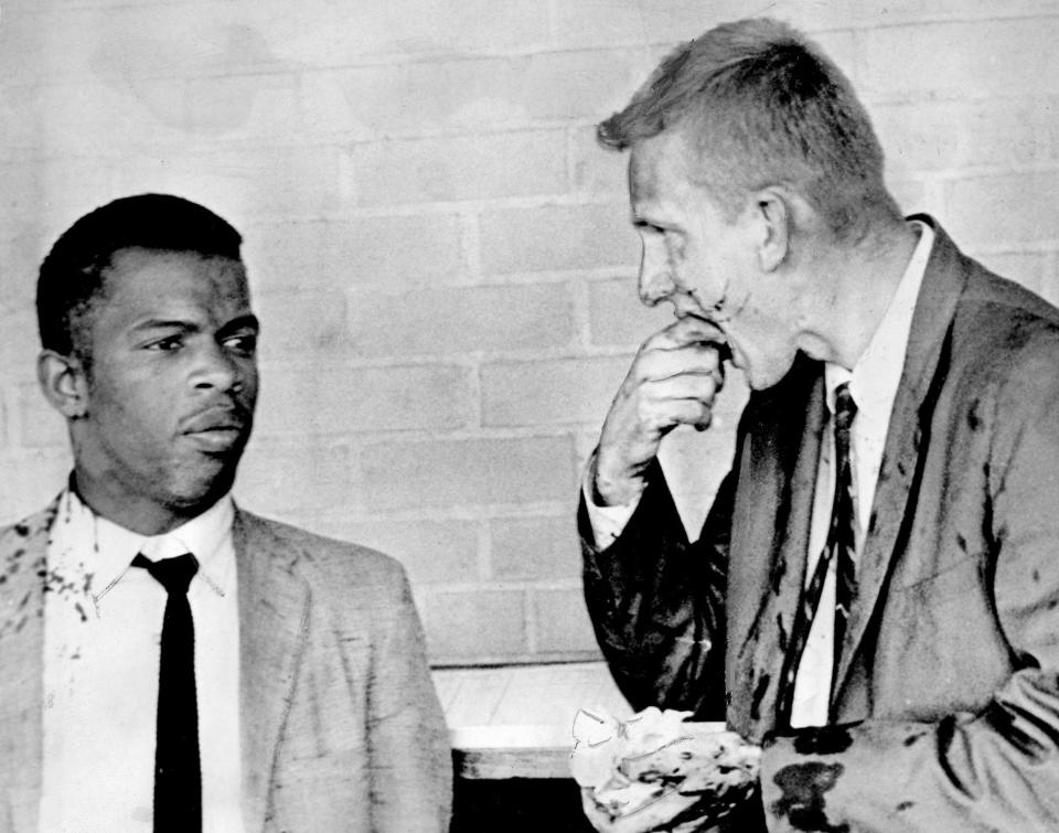 The Freedom Riders began protesting to desegregate public transit in the South in 1961. In this photo, John Lewis, left, one of the leaders, and Jim Zwerg, a Fisk student, check out their injuries after been beaten by a mob after they arrived in Montgomery, Alabama, May 20, 1961.