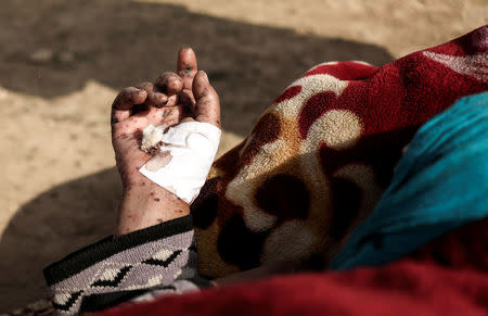 A displaced Iraqi injured women who just fled her home, waits to be transported while Iraqi forces battle with Islamic State militants in western Mosul, Iraq February 27, 2017. REUTERS/Zohra Bensemra