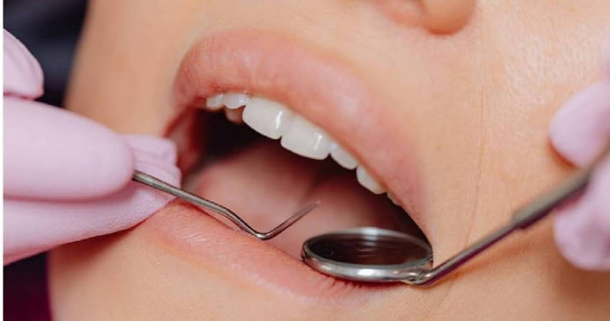 牙醫師表示，清除牙結石的頻率，還是要依據個人「刷牙習慣」與「進食頻率」來判斷。並非只要每半年洗一次牙，就可以高枕無憂。（圖／報系資料照）