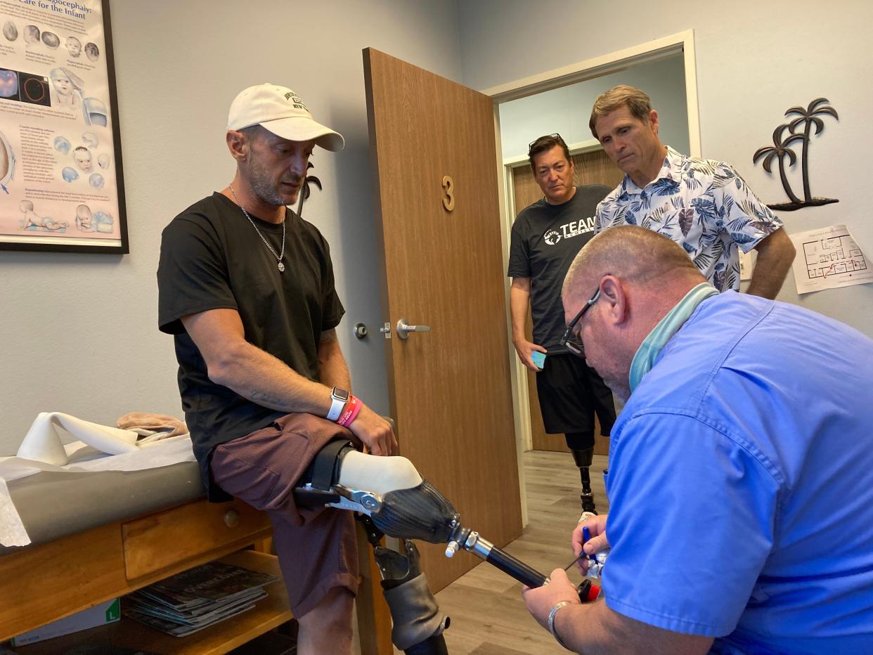 Fabrizio Passetti has his new prosthetic leg tightened by Dino LaCapria, a certified prosthetist at Channel Islands Prosthetics-Orthotics in Ventura on Nov. 2. Keith Severson, center with black shirt, and John McAtee watch the process.