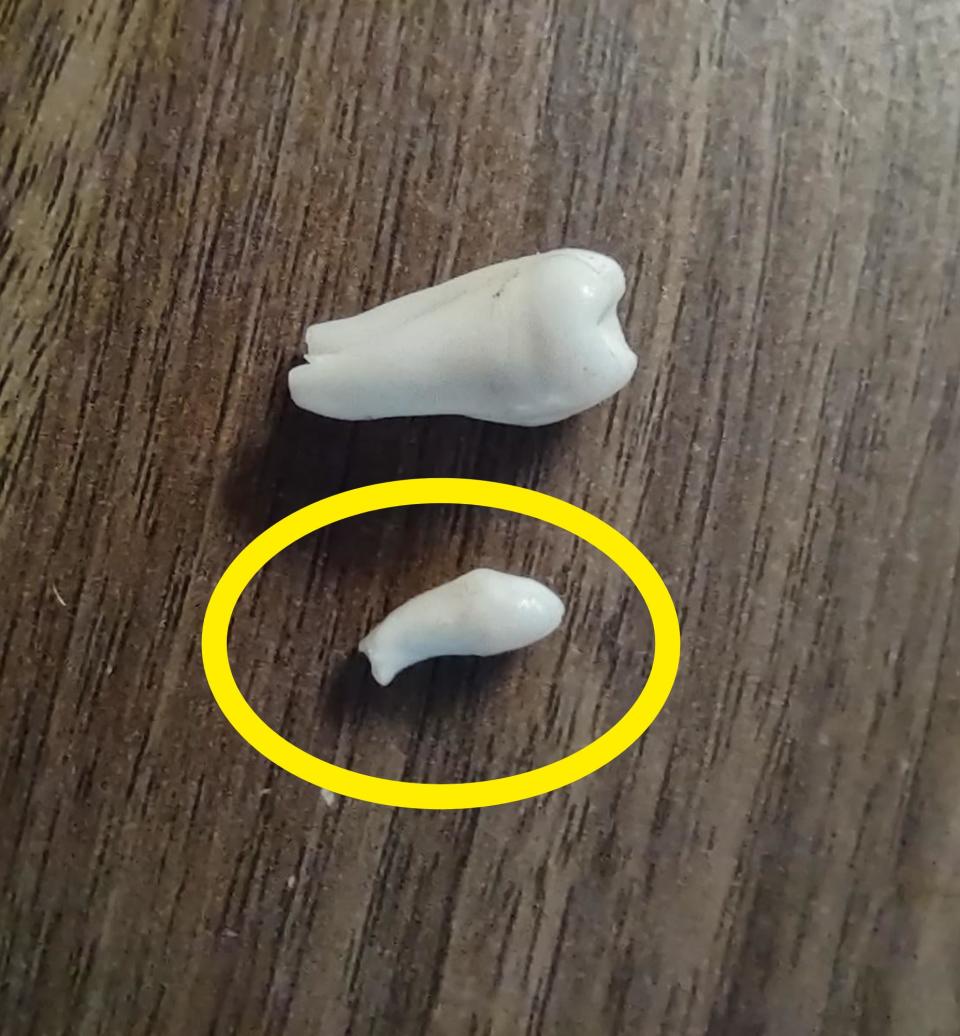 Two teeth side by side to show just how small one is