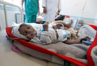 <p>A Yemeni child suspected of being infected with cholera receives treatment at a hospital in Sana’a on May 25, 2017.<br> Cholera has killed 315 people in Yemen in under a month, the World Health Organization has said, as another aid organisation warned Monday the outbreak could become a “full-blown epidemic”. (AFP/Getty Images) </p>