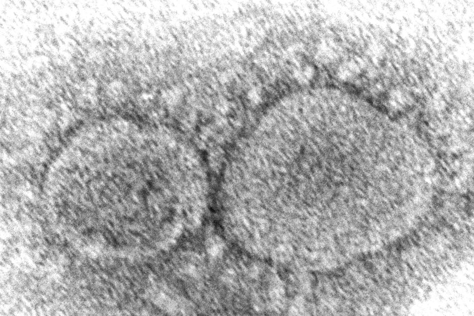 A 2020 electron microscope image of SARS-CoV-2 virus particles.