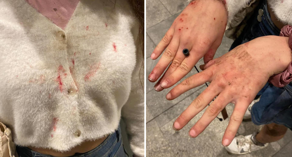 The teenager's white top can be seen splattered by blood and her hands are covered in scratches and mud. 