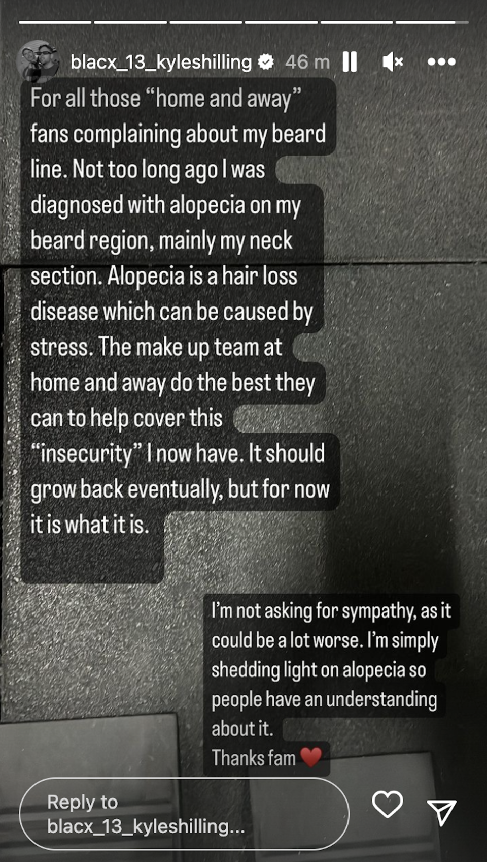 Kyle Shilling alopecia statement 