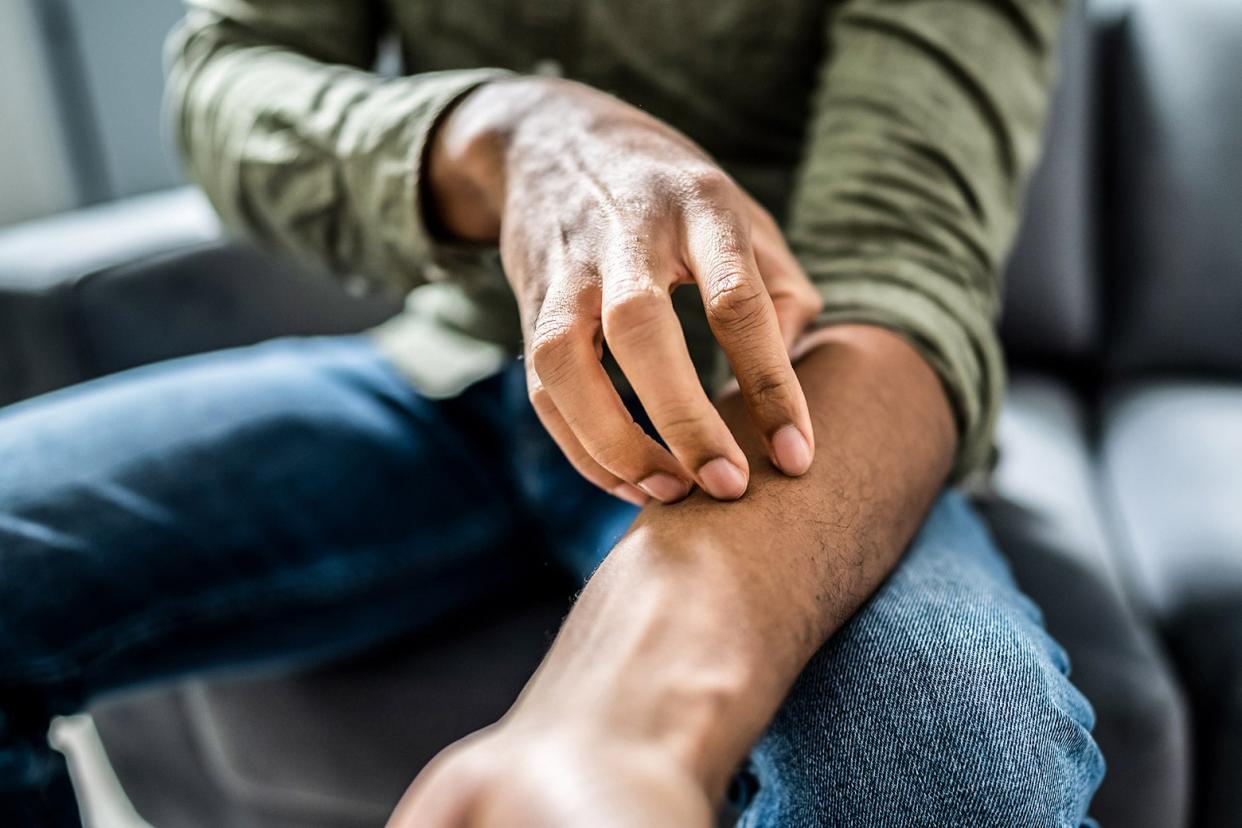 A person with rolled-up sleeves scratches their left forearm.