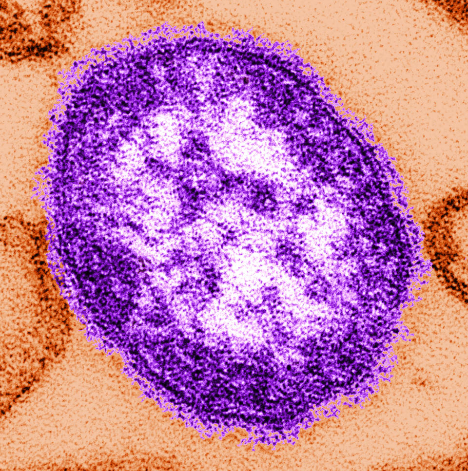 Esta imagen sin fecha divulgada por los Centros para el Control y Prevención de Enfermedades el 4 de febrero de 2015 muestra una imagen captada en un microscopio electrónico de una partícula del virus de sarampión, uno de los más infecciosos que se conocen. (Foto AP/Centros para el Control y Prevención de Enfermedades, Cynthia Goldsmith)