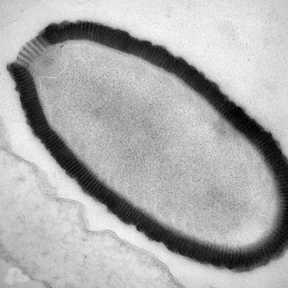 This electron microscope image provided by researchers in March 2014 shows a section of a Pithovirus particle, dark outline, inside an infected Acanthamoeba castellanii cell. The length of the particle is about 1.5 microns with a 0.5 micron diameter. Researchers have revived the virus, which is more than 30,000 years old, after finding it in the permafrost of northeast Siberia. While it poses no threat to people, its recovery suggests that dangerous germs might emerge in the future as permafrost thaws because of global warming or mineral exploration, researchers suggested Monday, March 3, 2014 in the Proceedings of the National Academy of Sciences. (AP Photo/IGS, CNRS-AMU, Julia Bartoli, Chantal Abergel)