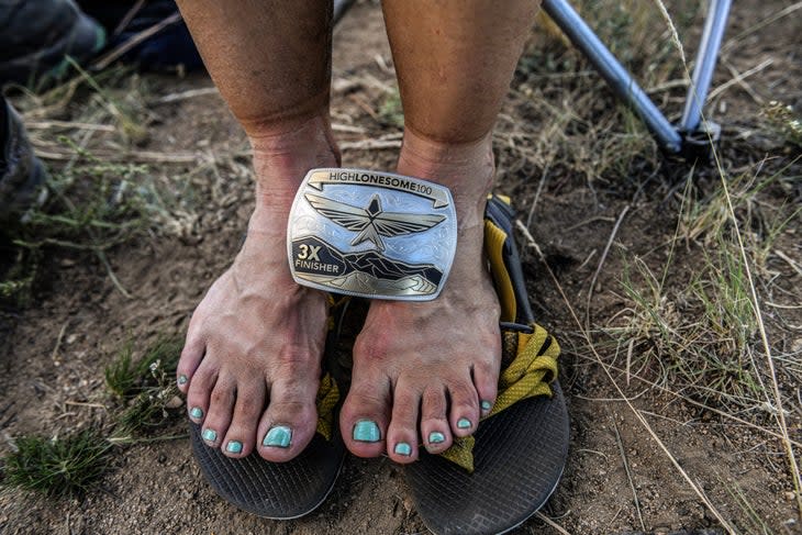<span class="article__caption">Silke Koester’s feet (and three-time finisher’s buckle) after finishing the High Lonesome 100.</span> (Photo: Kristi Mayo / Mile 90 Photography)