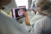 Medical workers check a X-ray photo of a lung of a patient suffering of COVID-19 in the Nouvel Hopital Civil of Strasbourg, eastern France, Thursday, Oct.22, 2020. France has seen over 34,000 confirmed deaths in the pandemic. (AP Photo/Jean-Francois Badias)