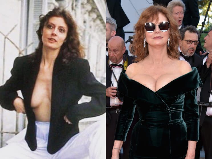 Susan Sarandon — Sex Symbol Gets Boob Job At 70