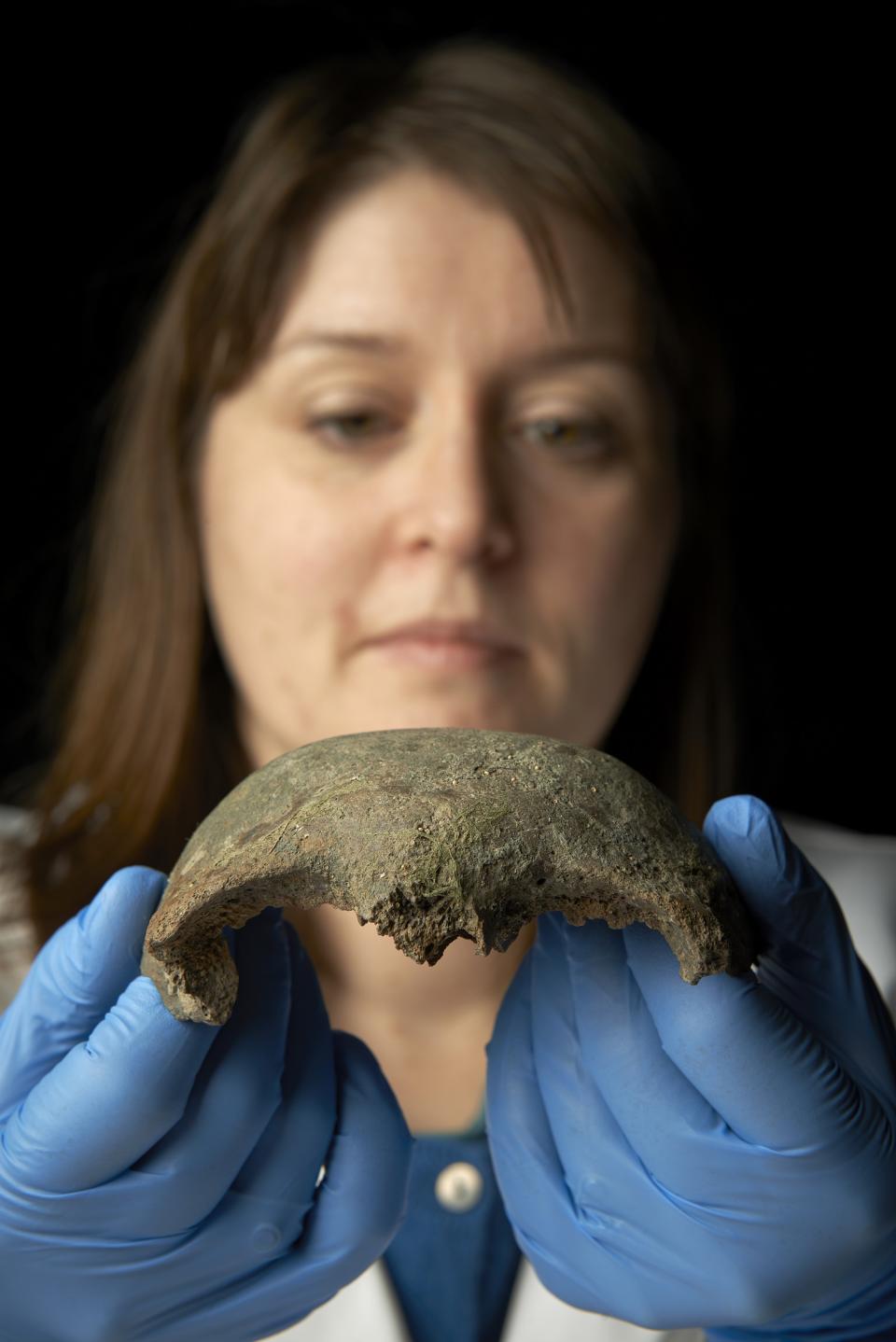 Dr Rebecca Redfern, from the Museum of London, with the fragment of skull discovered by the mudlarker. The fragment is one of the oldest discovered to date.