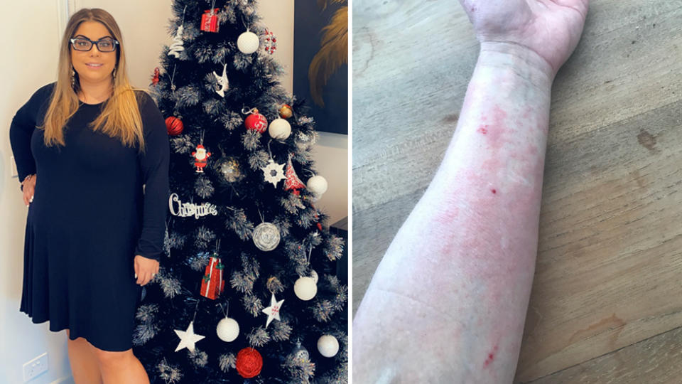 jo christmas tree allergy