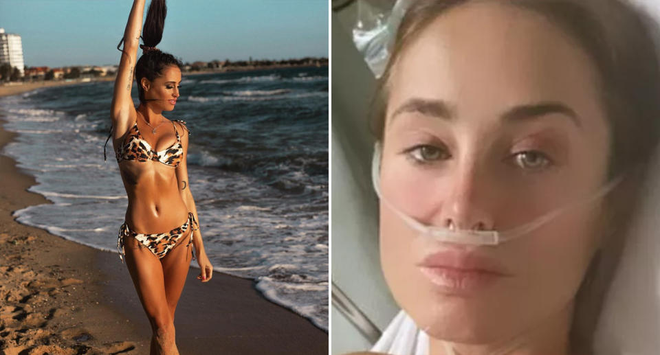 Courtney Mills posing on a beach and in a hospital bed in Bali.