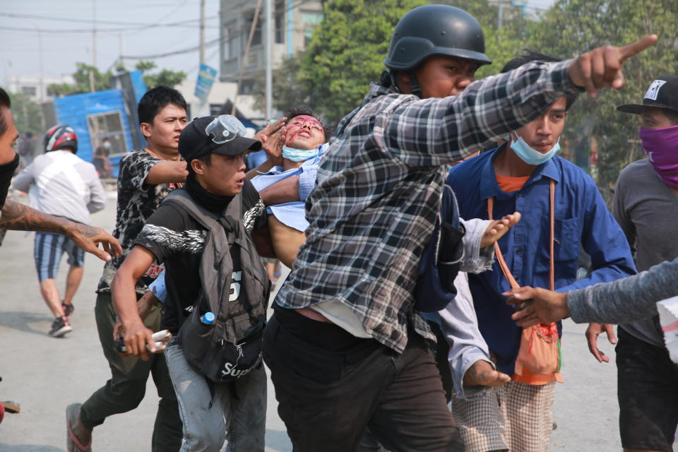 A man with a head injury is carried by other men Monday, March 22, 2021 in Mandalay, Myanmar. The BBC said Monday that a journalist from its Burmese-language service was released by authorities in Myanmar but gave no details, as protesters in the Southeast Asian nation continued their broad civil disobedience movement against last month's military coup. (AP Photo)