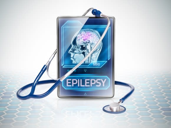 A stethoscope rests on a tablet displaying a graphic of a person's brain and the word epilepsy.