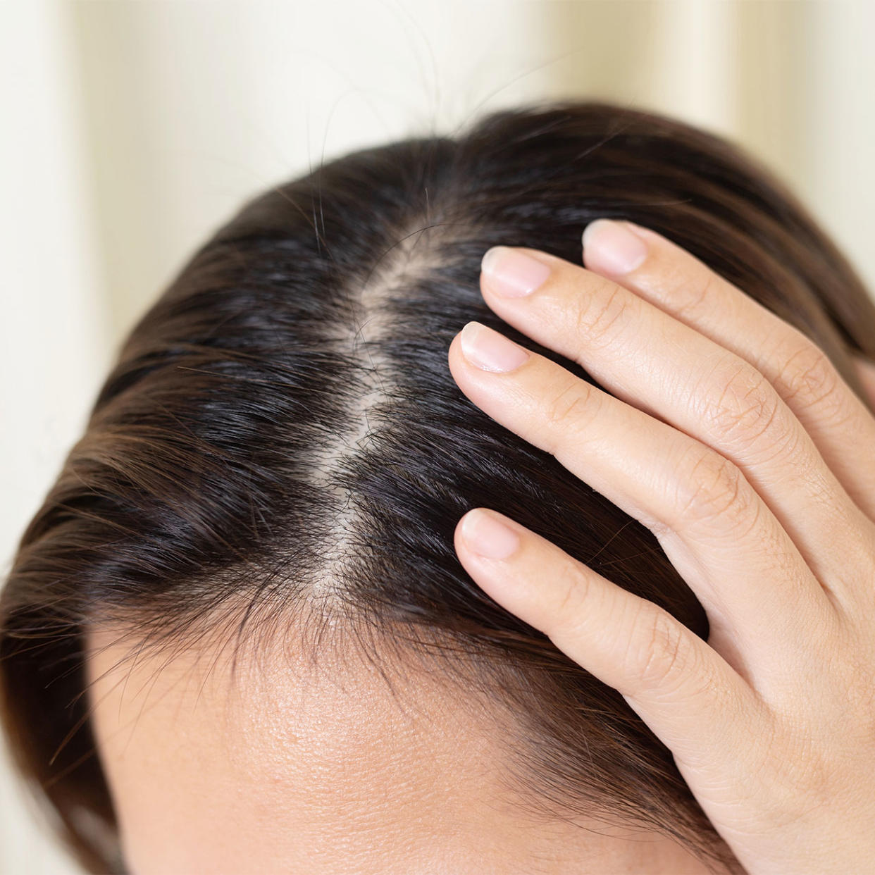 woman-sparse-scalp