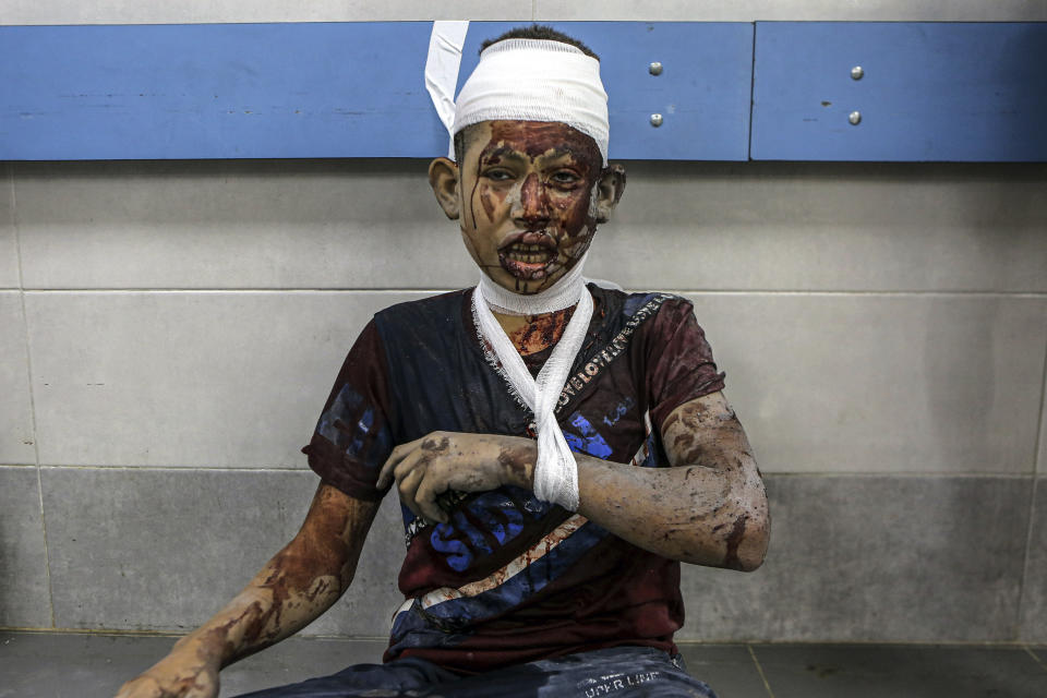 An injured Palestinian boy sits on the ground at the emergency room of the al-Shifa hospital, to receive treatment for his wounds following Israeli airstrikes on Gaza City, central Gaza Strip, Monday, Oct. 16, 2023. (AP Photo/Abed Khaled)