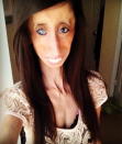 <div class="caption-credit"> Photo by: Lizzie Velasquez</div>Having no body fat or muscle tissue makes Lizzie Velasquez prone to injuries that most people would never think about -- like stress fractures in her feet from walking or standing, since the bottoms of her feet have no padding. (She's in a cast right now. "I fracture my foot if I'm not wearing the supportive shoes I'm supposed to wear," she confessed to Yahoo! Shine. "I'm usually wearing the cute shoes that match my outfit.") But it's made her think about New Years' resolutions, and how people are often focused on improving their outward appearances. "Instead of making it a goal to lose weight or to grow your hair longer, whatever it is to make yourself physically better, people should look toward making not only their character better, but helping others," she suggests. (Read her story: <a href="http://shine.yahoo.com/beauty/lessons-worlds-ugliest-woman-stop-staring-start-learning-184400606.html" data-ylk="slk:Lessons from "The World's Ugliest Woman": Stop Staring and Start Learning.);elm:context_link;itc:0;sec:content-canvas;outcm:mb_qualified_link;_E:mb_qualified_link;ct:story;" class="link  yahoo-link">Lessons from "The World's Ugliest Woman": Stop Staring and Start Learning.) <br></a>