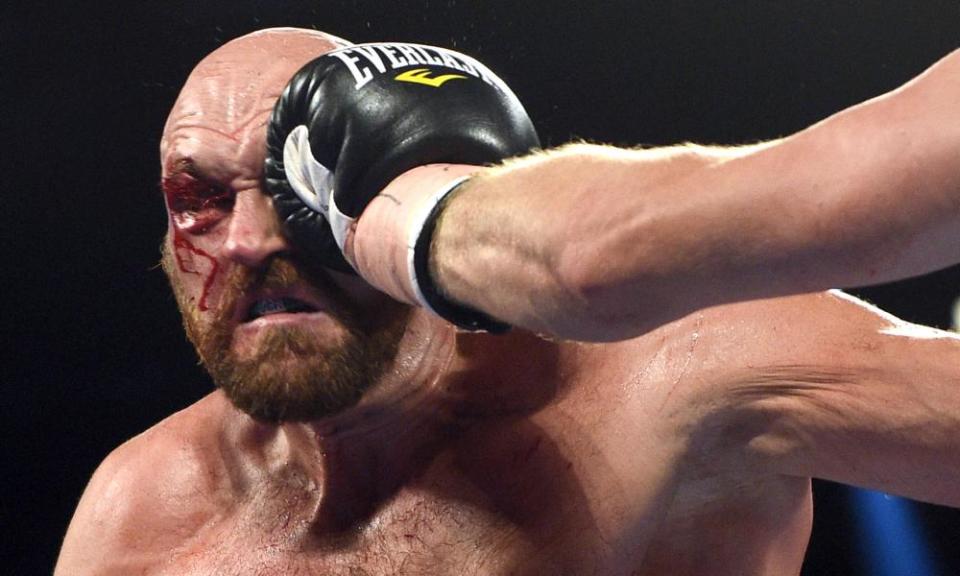 Tyson Fury takes a hit during his heavyweight bout against Otto Wallin in September.