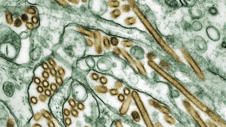 PHOTO: Colorized transmission electron micrograph of Avian influenza, H5N1 viruses (seen in gold) grown in MDCK cells (seen in green).  (Smith Collection/GADO/Getty Images)