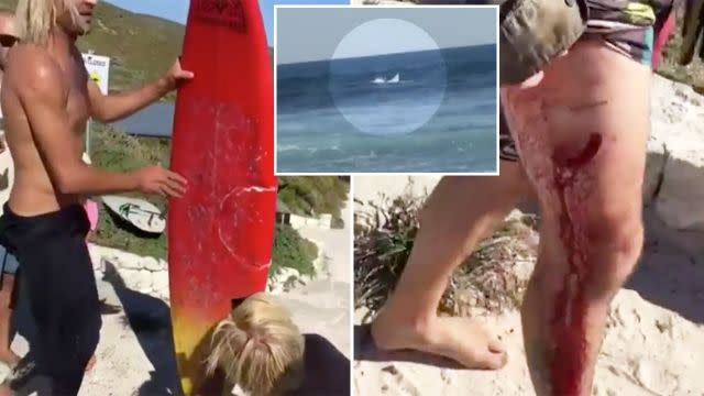 You can see the jaw marks in Jason's board and the damage it did to his leg. Image: Channel 7