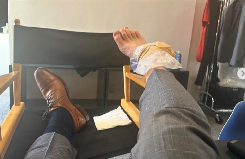 Chris Pratt has hurt his ankle (c) Instagram credit:Bang Showbiz