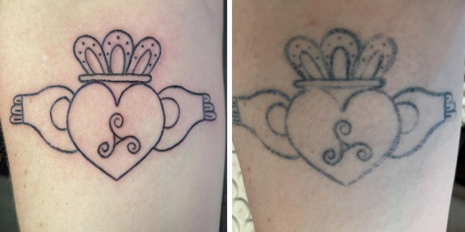 Cuando Barbara Edmonds se hizo un tatuaje de un anillo de Claddagh en Ephemeral, un estudio de tatuajes temporales, en agosto de 2021, le dijeron que iba a 