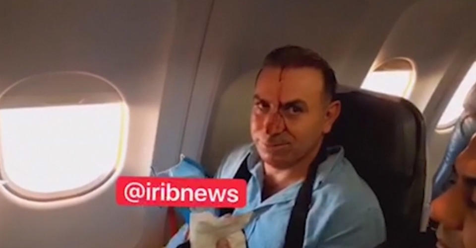 Image: Close-up of a passenger sitting by window with blood on his face in a screenshot from footage purportedly shot by a reporter for Iranian state TV. (IRIB via The Associated Press)